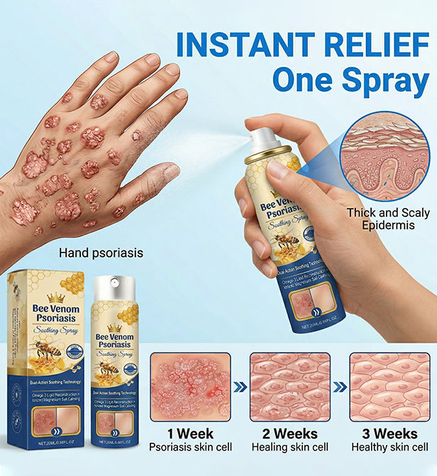 Dermynex™ Advanced Recovery Mist: Triple-Active Relief for Psoriasis & Eczema-Prone Skin with Bee Venom & Omega-3【Free Tax】