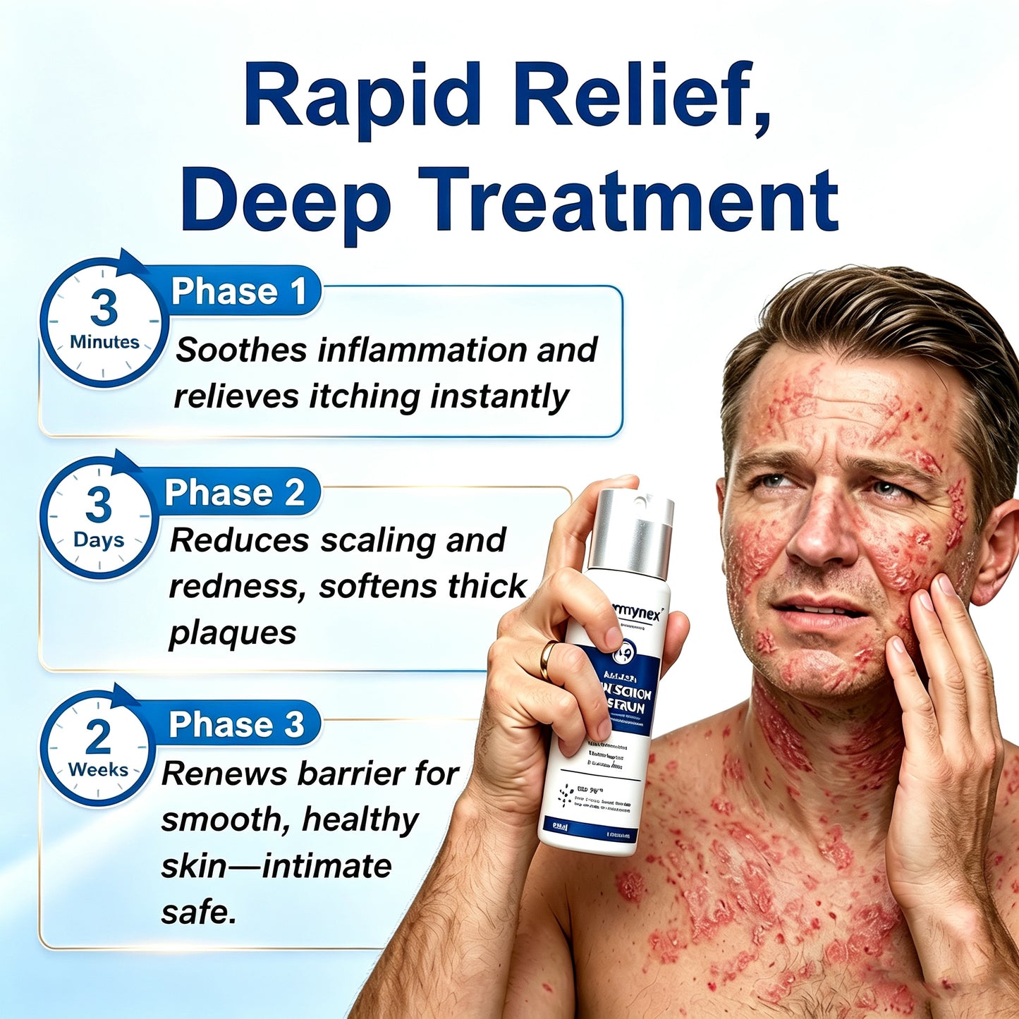 Dermynex™ Psoriasis & Eczema Relief Spray — Advanced Skin Recovery Mist with Bee Venom & Omega-3