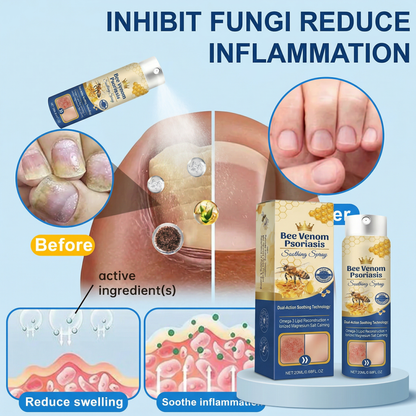 Dermynex™ Advanced Recovery Mist: Triple-Active Relief for Psoriasis & Eczema-Prone Skin with Bee Venom & Omega-3【Free Tax】