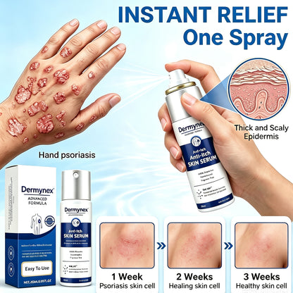 Dermynex™ Psoriasis & Eczema Relief Spray — Advanced Skin Recovery Mist with Bee Venom & Omega-3