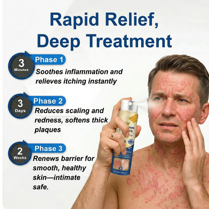 Dermynex™ Advanced Recovery Mist: Triple-Active Relief for Psoriasis & Eczema-Prone Skin with Bee Venom & Omega-3【Free Tax】
