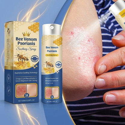 Dermynex™ Advanced Recovery Mist: Triple-Active Relief for Psoriasis & Eczema-Prone Skin with Bee Venom & Omega-3【Free Tax】