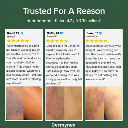 Dermynex Antifungal Soap
